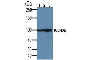 Western blot analysis of (1) Human 293T Cells, (2) Human PC-3 Cells and (3) Human MCF-7 Cells.