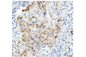 IHC analysis of ATG4A using anti-ATG4A antibody (ABIN7603108). (ATG4A antibody  (N-Term))