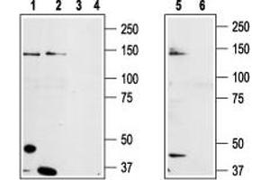 Western blot analysis of prostate carcinoma cell lines DU145 (lanes 1 and 3), Human LNCaP prostate carcinoma (lanes 2 and 4) and mouse-TRPM8 transfected HEK-293 (lanes 5 and 6) cell lysates: - 1,2,5.
