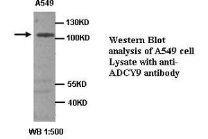Image no. 1 for anti-Adenylate Cyclase 9 (ADCY9) antibody (ABIN1574484)