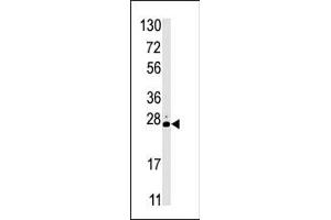 Western blot analysis of anti-STK19 Pab (ABIN391281 and ABIN2837967) in HL60 cell line lysate (35 μg/lane). (STK19 antibody  (C-Term))