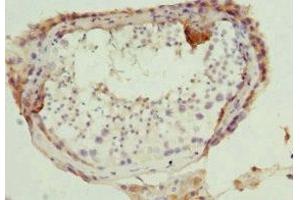 Immunohistochemistry of paraffin-embedded human testis tissue using ABIN7165308 at dilution of 1:100 (DR1 antibody  (AA 1-176))