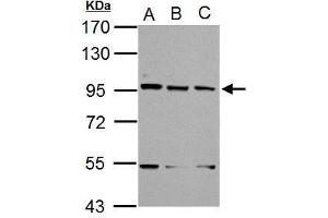 WB Image Sample (30 ug of whole cell lysate) A: NIH-3T3 B: JC C: BCL-1 7. (XAB2 antibody  (N-Term))