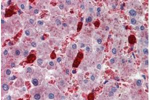 Human Liver: Formalin-Fixed, Paraffin-Embedded (FFPE) (Cell Adhesion Molecule 4 antibody  (AA 370-384))