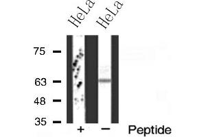 Western blot analysis of FZD2 expression in HeLa cells