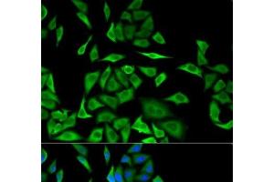 Immunofluorescence analysis of MCF-7 cells using DBI Polyclonal Antibody