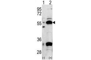 Image no. 1 for anti-Pyruvate Dehydrogenase Complex, Component X (PDHX) (C-Term) antibody (ABIN357414) (PDHX antibody  (C-Term))