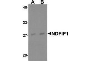 Western blot analysis of NDFIP1 in PC-3 cell lysate with NDFIP1 Antibody  at (A) 0. (NDFIP1 antibody  (N-Term))