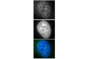 Immunohistochemistry (IHC) image for anti-DNA Repair Protein Homolog 1 (RAD51) antibody (ABIN2452093) (RAD51 antibody)