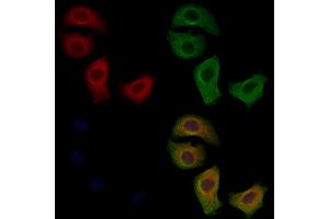 VPS41 Antibody staining Hela cells by IF/ICC.