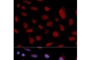 Immunofluorescence analysis of U2OS cells using TNNC1 Polyclonal Antibody (TNNC1 antibody)