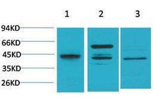 Western Blotting (WB) image for anti-Caspase 8 (CASP8) antibody (ABIN3179105) (Caspase 8 antibody)