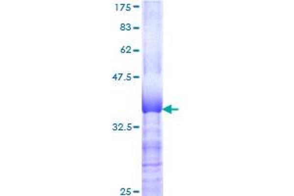ZNF131 Protein (AA 139-238) (GST tag)