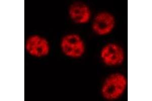 ABIN6267061 staining HeLa by IF/ICC. (NF-kB p65 antibody  (acLys310))