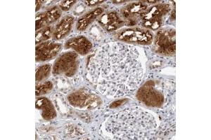 Immunohistochemical staining (Formalin-fixed paraffin-embedded sections) of human kidney with RAB11FIP3 polyclonal antibody  shows strong cytoplasmic and membrane positivity in renal tubules. (RAB11FIP3 antibody)