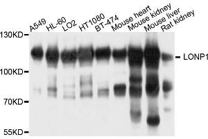 Western blot analysis of extract of various cells, using LONP1 antibody. (LONP1 antibody)