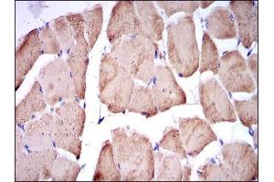 Immunohistochemistry (IHC) image for anti-Fast Skeletal Troponin I (TNNI2) antibody (ABIN969441)