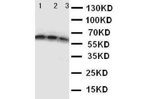 Anti-CD40 antibody,  Western blotting Lane 1: Recombinant Human CD40 Protein 10ng Lane 2: Recombinant Human CD40 Protein 5ng Lane 3: Recombinant Human CD40 Protein 2.