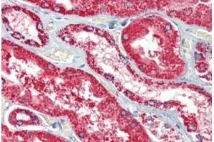 Kidney, Human: Formalin-Fixed, Paraffin-Embedded (FFPE) (HSPD1 antibody)