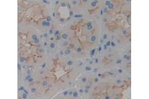 IHC-P analysis of Human Tissue, with DAB staining. (TMEM27 antibody  (AA 17-137))