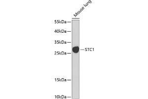 Western blot analysis of extracts of mouse lung, using STC1 Antibody (ABIN6128750, ABIN6148585, ABIN6148586 and ABIN6222488) at 1:1000 dilution. (Stanniocalcin 1 antibody  (AA 18-247))
