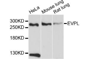 Western blot analysis of extracts of various cell lines, using EVPL antibody.