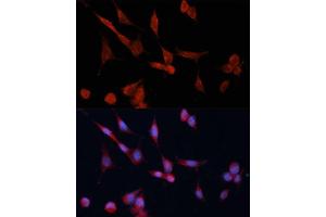 Immunofluorescence analysis of NIH-3T3 cells using DD Polyclonal Antibody (ABIN6127748, ABIN6139455, ABIN6139456 and ABIN6214493) at dilution of 1:100 (40x lens). (DDAH1 antibody  (AA 1-285))