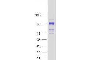 Validation with Western Blot