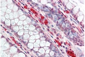 Immunohistochemistry (IHC) image for anti-SWI/SNF Related, Matrix Associated, Actin Dependent Regulator of Chromatin, Subfamily E, Member 1 (SMARCE1) (N-Term) antibody (ABIN2780465)