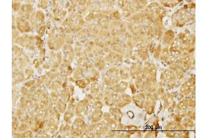 Immunoperoxidase of monoclonal antibody to WASL on formalin-fixed paraffin-embedded human pancreas. (Neural Wiskott-Aldrich syndrome protein (WASL) (AA 97-184) antibody)