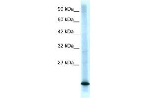 WB Suggested Anti-CDKN2B Antibody Titration:  0. (CDKN2B antibody  (Middle Region))