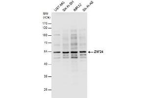 WB Image ZNF24 antibody detects ZNF24 protein by western blot analysis.
