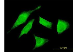 Immunofluorescence of monoclonal antibody to UTRN on HeLa cell. (Utrophin antibody  (AA 3328-3433))