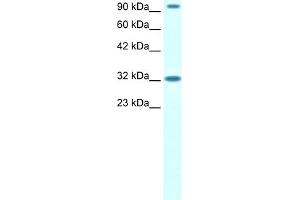 WB Suggested Anti-CIC Antibody Titration:  1.