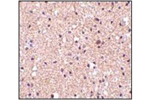Immunohistochemistry of op18 in human brain tissue with this product at 2. (Stathmin 1 antibody  (C-Term))