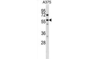 Western Blotting (WB) image for anti-Sorting Nexin 2 (SNX2) antibody (ABIN2998549) (Sorting Nexin 2 antibody)