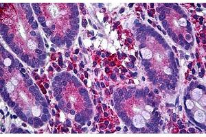 Anti-LIMK1 antibody IHC staining of human small intestine. (LIM Domain Kinase 1 antibody  (AA 548-648))
