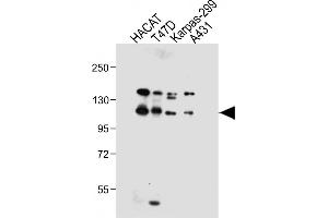 All lanes : Anti-RN2 Antibody (C-term) at 1:1000 dilution Lane 1: HACAT whole cell lysate Lane 2: T47D whole cell lysate Lane 3: Karpas-299 whole cell lysate Lane 4: A431 whole cell lysate Lysates/proteins at 20 μg per lane. (MMRN2 antibody  (C-Term))