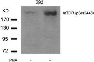 Image no. 3 for anti-Mechanistic Target of Rapamycin (serine/threonine Kinase) (mTOR) (pSer2448) antibody (ABIN196962) (MTOR antibody  (pSer2448))