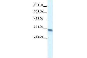 Western Blot showing FHL2 antibody used at a concentration of 1-2 ug/ml to detect its target protein. (FHL2 antibody  (C-Term))