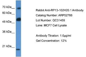 Western Blotting (WB) image for anti-rho GTPase Activating Protein 36 (ARHGAP36) (N-Term) antibody (ABIN2785083) (ARHGAP36 antibody  (N-Term))