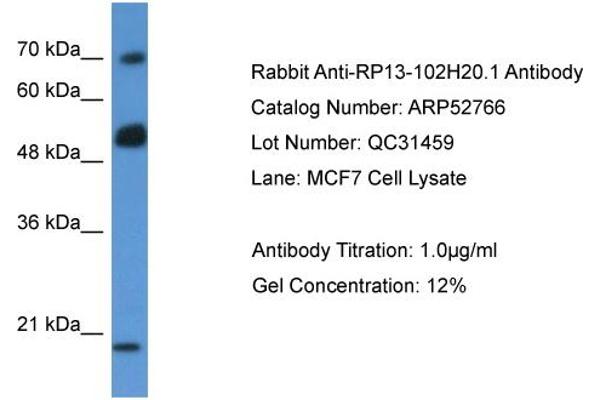 ARHGAP36 anticorps  (N-Term)