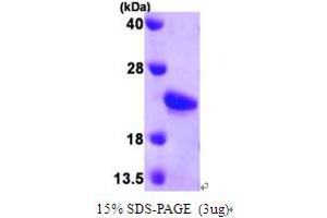 SDS-PAGE (SDS) image for Sonic Hedgehog (SHH) (AA 25-198) protein (His tag) (ABIN666981)