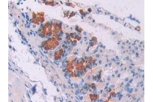 Detection of OSM in Mouse Stomach Tissue using Polyclonal Antibody to Oncostatin M (OSM)