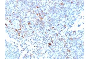 Formalin-fixed, paraffin-embedded human Lymph Node stained with TRAF1 Mouse Monoclonal Antibody (TRAF1/2770). (TRAF1 antibody  (AA 73-219))
