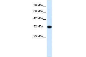 WB Suggested Anti-ZBTB32 Antibody Titration: 0. (ZBTB32 antibody  (N-Term))