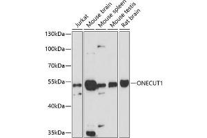 Western blot analysis of extracts of various cell lines, using ONECUT1 antibody (ABIN6132821, ABIN6145027, ABIN6145029 and ABIN6216522) at 1:3000 dilution. (ONECUT1 antibody  (AA 167-292))