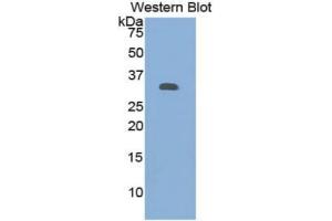 WB of Protein Standard: different control antibodies  against Highly purified E. (Granulin ELISA Kit)