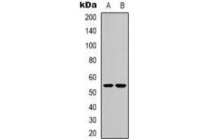 Western blot analysis of CHRNA9 expression in Jurkat (A), HEK293T (B) whole cell lysates. (CHRNA9 antibody  (N-Term))