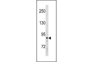 SUZ12 Antibody (C-term) (ABIN1881858 and ABIN2843258) western blot analysis in Ramos cell line lysates (35 μg/lane). (SUZ12 antibody  (C-Term))
